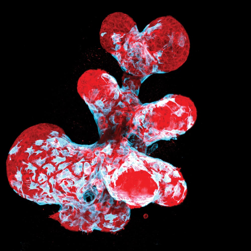 Photomicrography-M2woman